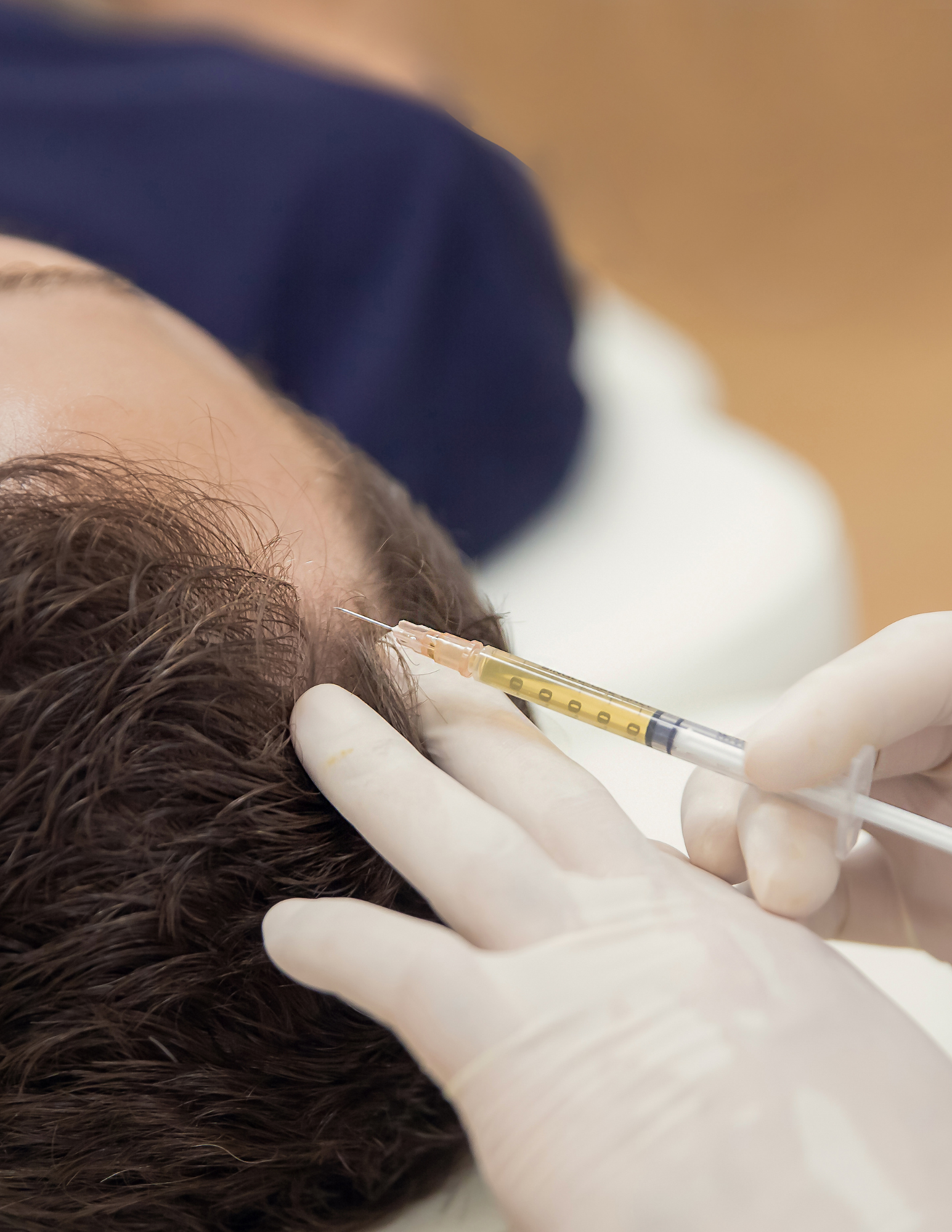 Dr Brouk PRP Hair Restoration PRP procedure